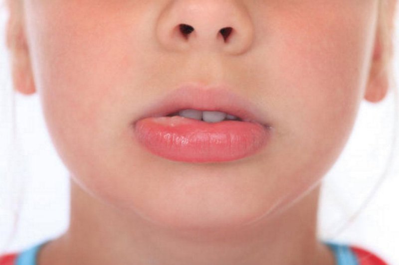 Can sleeping habits contribute to swollen lips